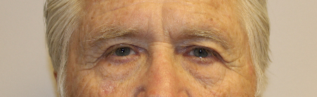 Patient # 66513 After Photo # 4