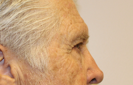 Patient # 66513 After Photo # 2